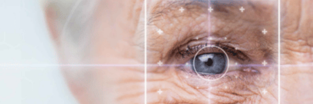 Факоэмульсификация катаракты