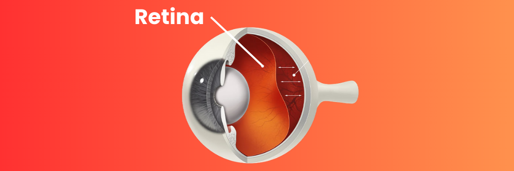 Заболевания Сетчатки